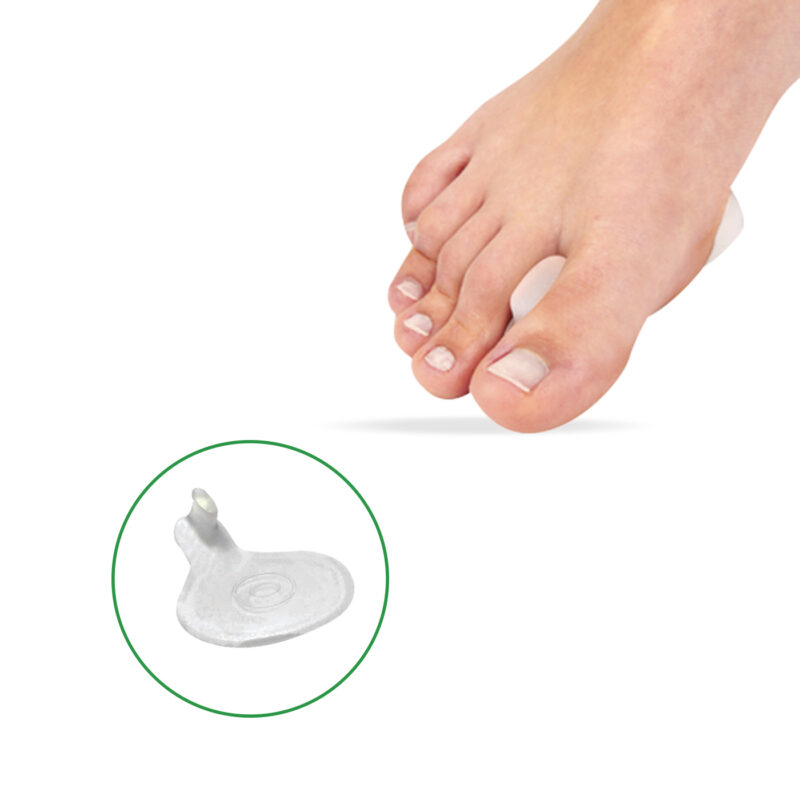 coussin métatarsien