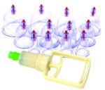 Ventouses de hijama